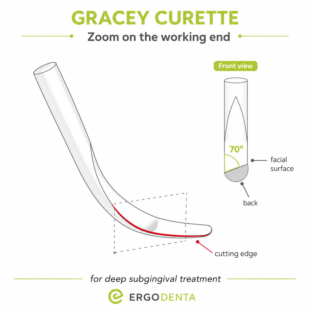 Gracey curette working end — 70° offset blade, single cutting edge