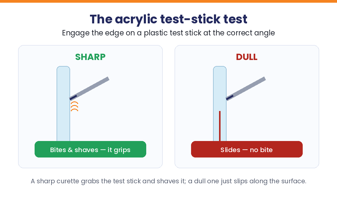 Test-stick test: a sharp curette bites the acrylic stick, a dull one slides